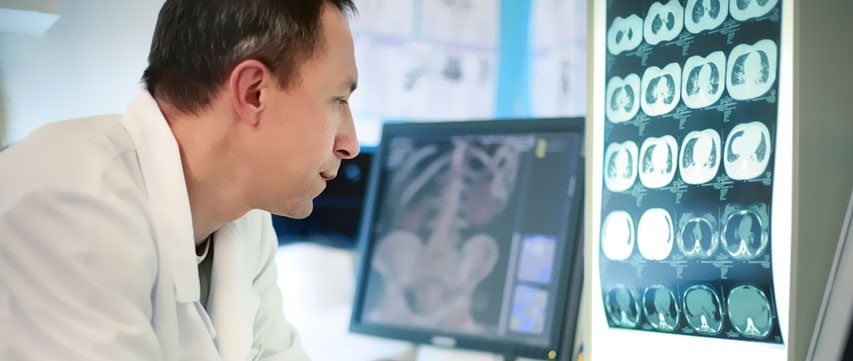 Radiologia, In Campania 10 milioni di euro in fumo per prestazioni inappropriate