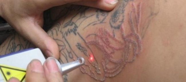Tatoo, gli italiani si pentono