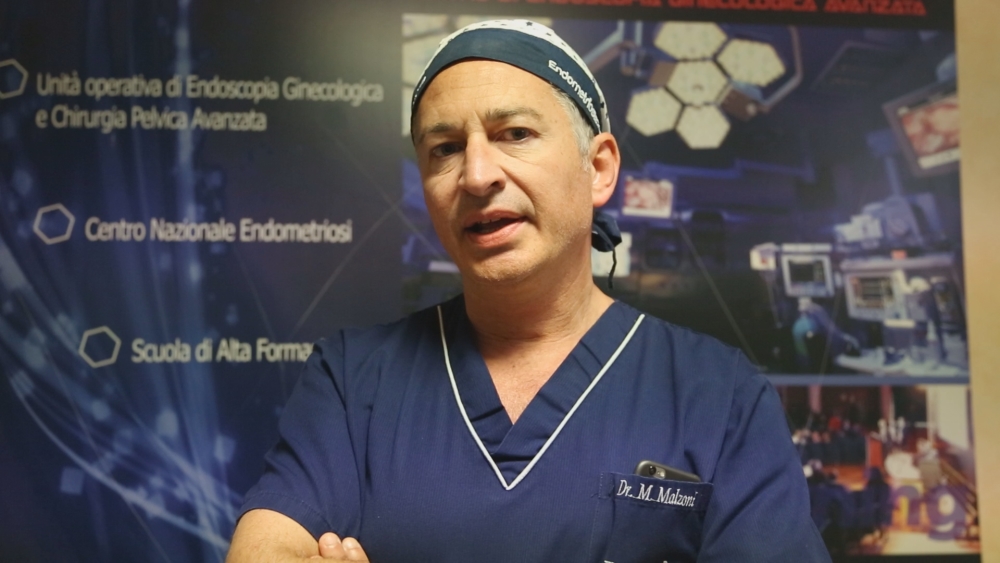 Avellino| Chirurgia in 3D con il modello Malzoni