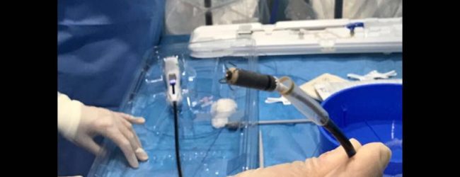 Benevento| Intervento cardiaco senza incisioni