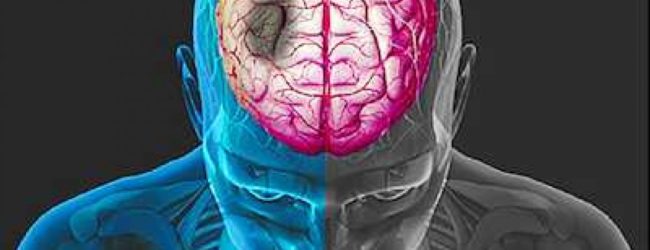 Aprile, il mese della prevenzione dell’Ictus.Prima regola: smettere di fumare