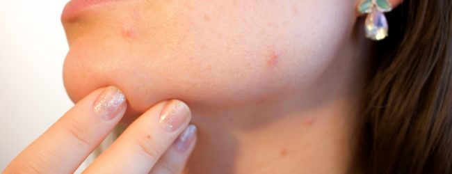 Villa Mafalda, novità e sviluppi della dermatologia