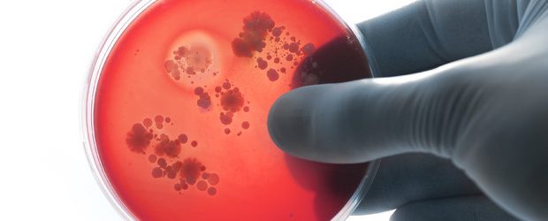 Benevento| Caso meningite: maestra fuori pericolo