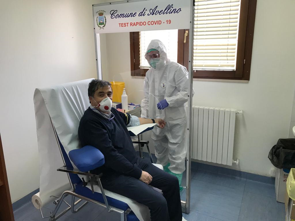 Avellino| Test rapidi, ecco i kit acquistati dal Comune: il primo a fare l’esame è il presidente dell’Ordine dei Medici