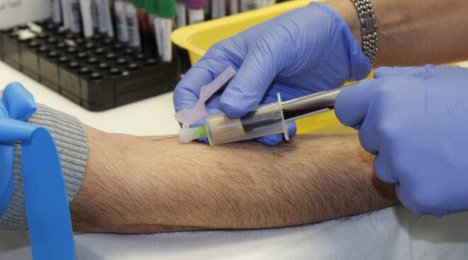 A Calvi saranno effettuati anche test sierologici con prelievo venoso