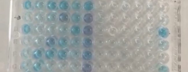 Covid-19: messo a punto il test sierologico made in Sannio