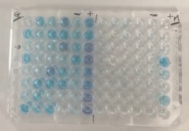 Covid-19: messo a punto il test sierologico made in Sannio