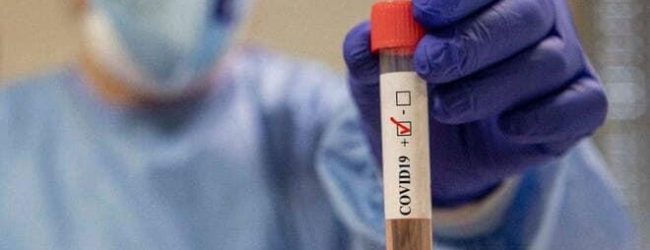 Covid-19, secondo caso a Durazzano