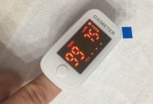 Covid: saturimetro,un valido alleato per i pazienti a casa