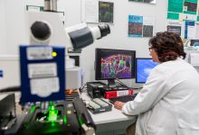 Telese Terme| Polineuropatia diabetica: una ricerca dell’IRCCS Maugeri sulla copertina di Pain. I neurologi dell’Istituto hanno osservato per la prima volta sull’uomo l’aumento di fibre nervose associate al dolore