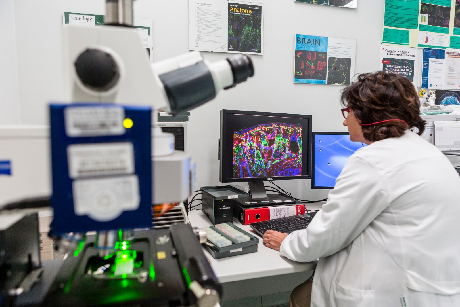 Telese Terme| Polineuropatia diabetica: una ricerca dell’IRCCS Maugeri sulla copertina di Pain. I neurologi dell’Istituto hanno osservato per la prima volta sull’uomo l’aumento di fibre nervose associate al dolore