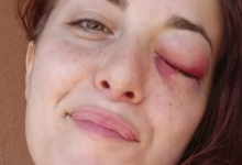 ‘Un uomo dopo aver toccato una donna smette di essere un uomo’: la denuncia di Giuliana Danze’