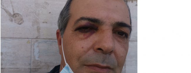 Benevento|Autista aggredito, Anzalone(Filt Cgil): pronti a proclamare stato di agitazione del trasporto pubblico