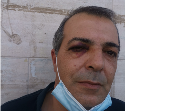 Benevento|Autista aggredito, Anzalone(Filt Cgil): pronti a proclamare stato di agitazione del trasporto pubblico