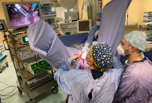 Avellino| Chirurgia ginecologica mininvasiva V-Notes, al “Moscati” i primi due interventi