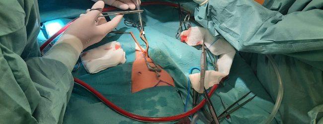 Sinergia tra specialisti salva la vita a neonato di Caserta, stabilizzato al Moscati e trasferito al Bambin Gesù