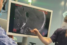 San Pio, la direzione: “I neurochirurghi via per problemi personali, non per ‘carenza’ di formazione”