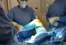 Ospedale Fatebenefratelli, intervento di protesi al ginocchio: Il Computer affianca il chirurgo