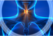Benevento, domani il convegno sul “Carcinoma orale: attuali orientamenti in clinica e terapia”
