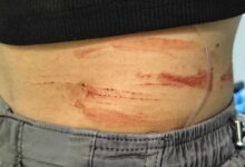 Forino| Studentessa 17enne aggredita da un uomo, foto sui social e indagini in corso