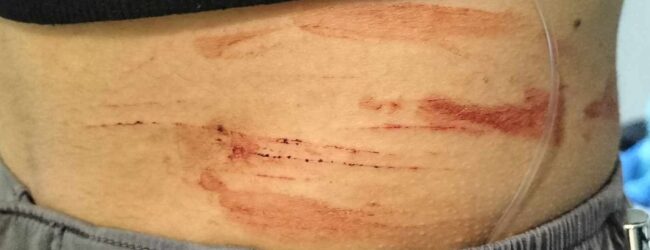 Forino| Studentessa 17enne aggredita da un uomo, foto sui social e indagini in corso