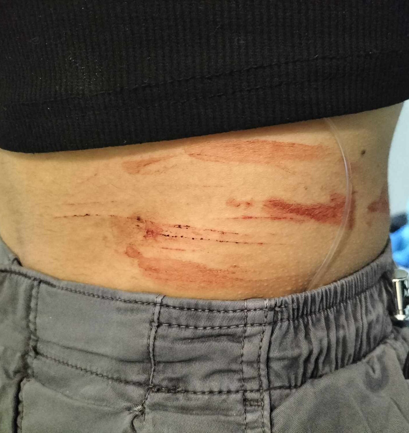 Forino| Studentessa 17enne aggredita da un uomo, foto sui social e indagini in corso