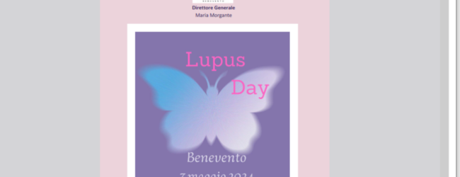 Lupus Eritematoso Sistemico, il 7 maggio convegno al “San Pio” di Benevento