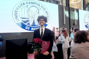 Artrite psorisiaca, laurea con lode in medicina per il neodottore Lorenzo Fusco